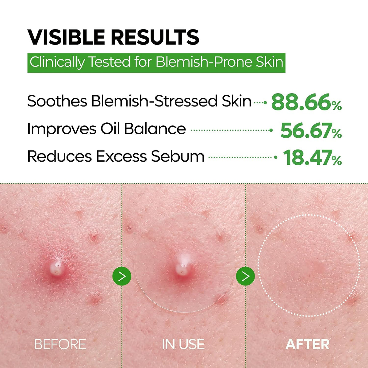 💄 PRE-MAKEUP SPOT PATCHES | Ultra-Thin Clear Blemish & Dark Spot Patches for a Smoother Makeup Finish