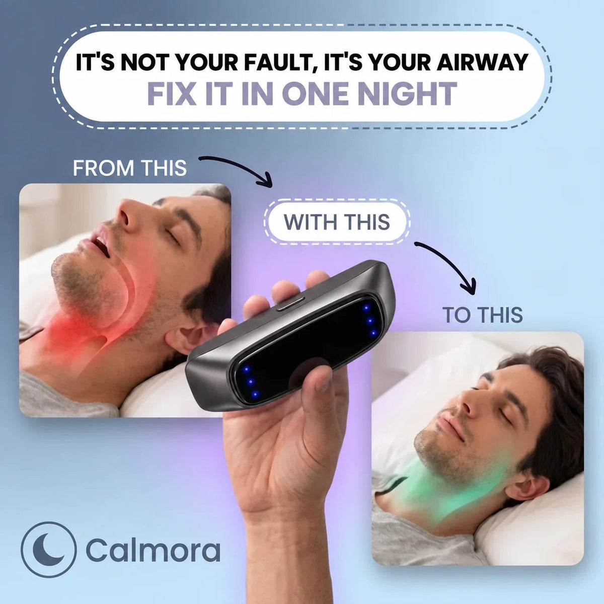 Snore-Responsive Wearable – Under-Chin Vibration Device