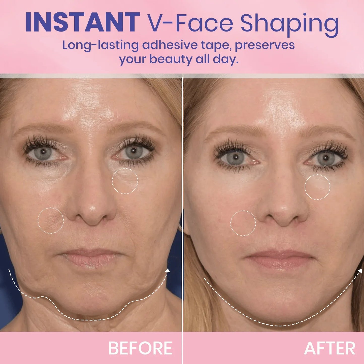 V-Face⭐ Lifting Invisible Adhesive Tape