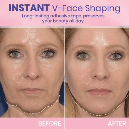 V-Face⭐ Lifting Invisible Adhesive Tape