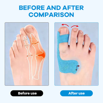 Pre-Cut Bunion Relief Kinesiology Tape 💪Ready-to-Use Corrector Strips
