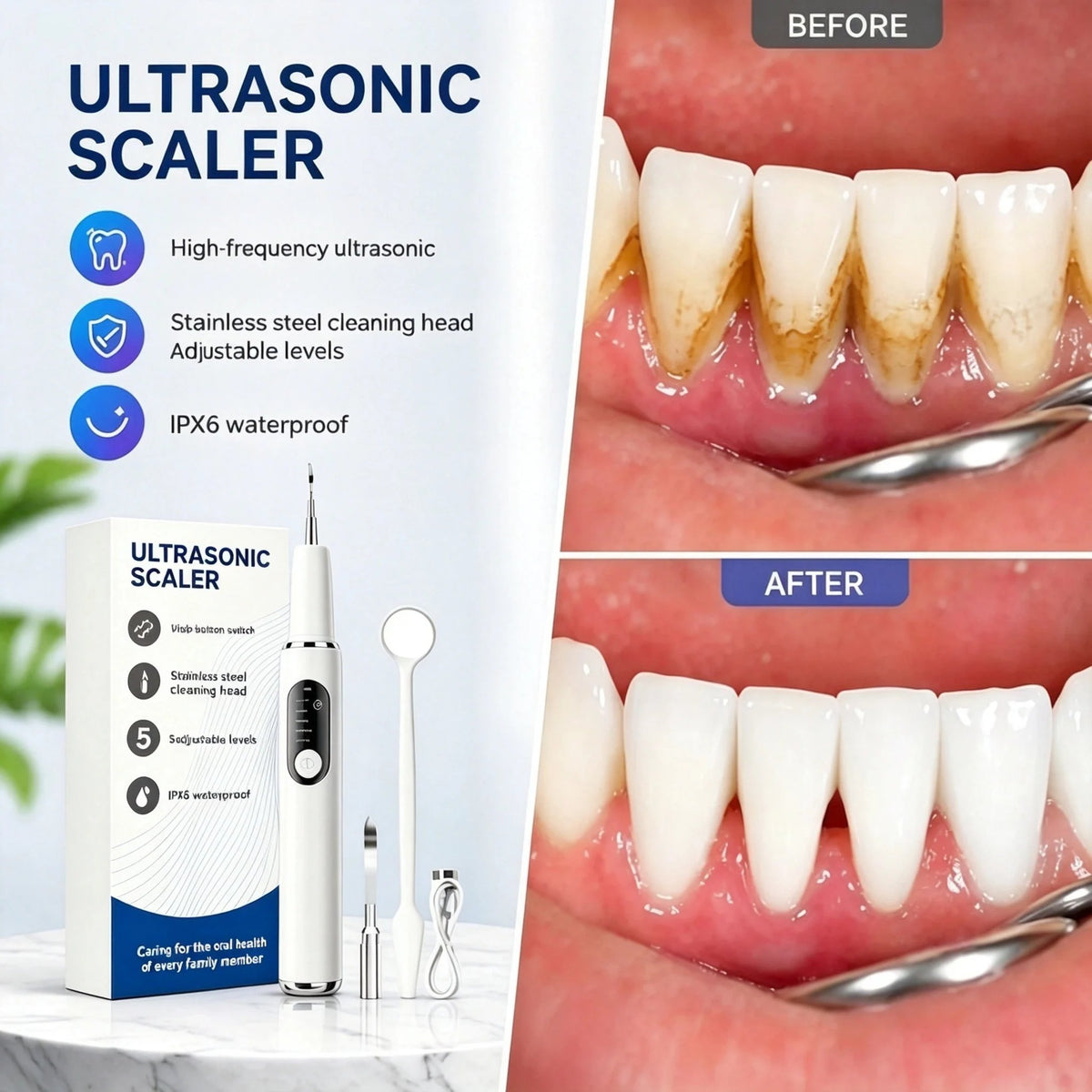 📢📢50% OFF !! ⏰Portable Ultrasonic Teeth Cleaner and Tartar Remover Set