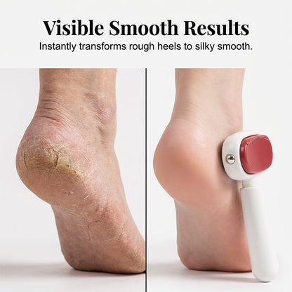 🦶Dual‑Sided Foot Callus Remover, Replaceable Stainless Steel Blade Foot Scraper
